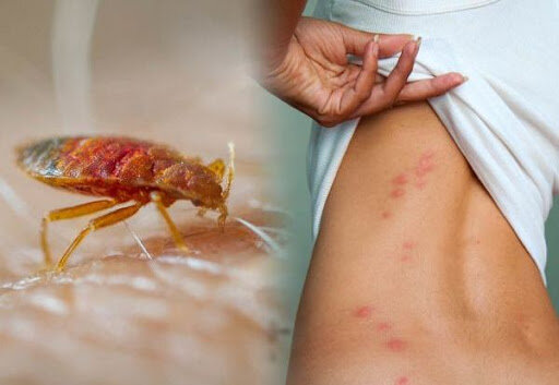 Источник: http://domiksna.com/sovety-hozyajke/kak-izbavitsya-ot-postelnyih-klopov.html