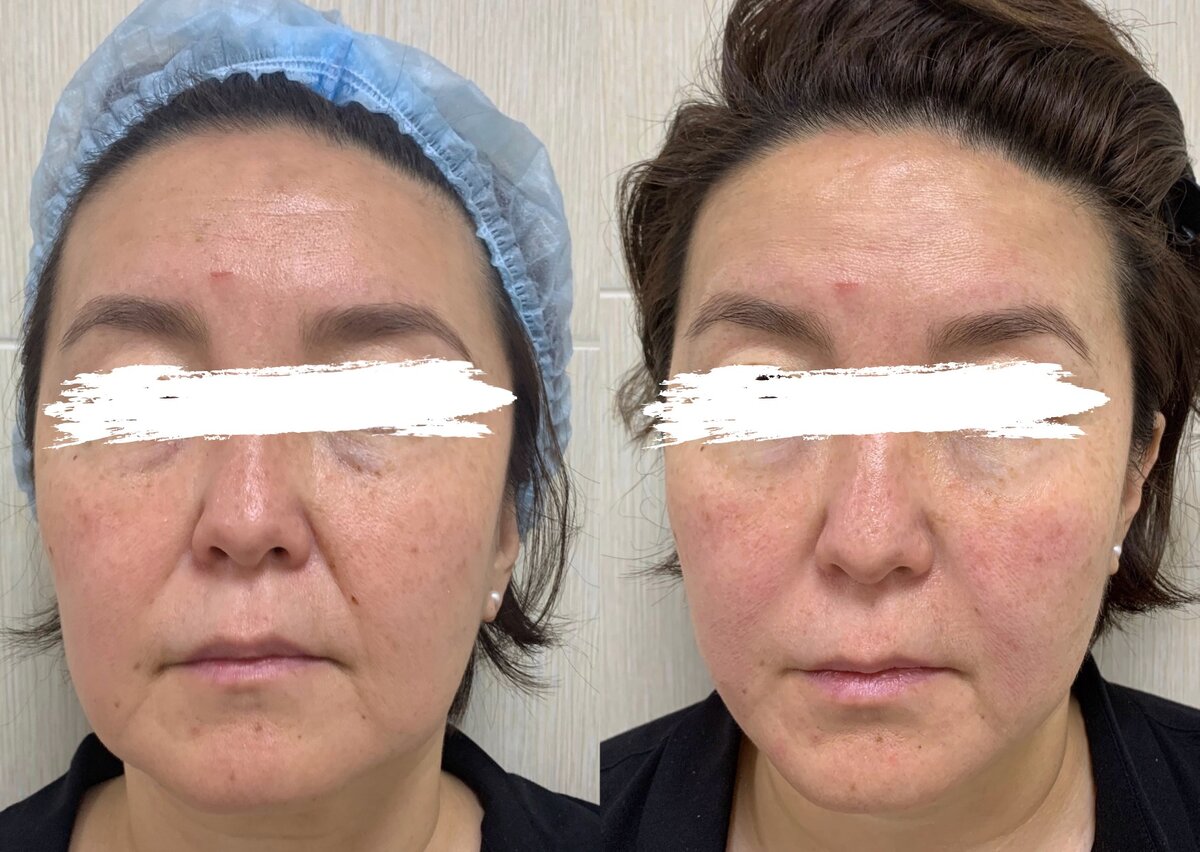 Клиника эстетической медицины и косметологии FaceLifting Москва