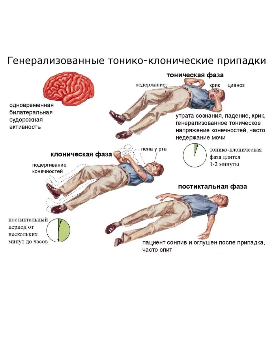 Подборка судорожные