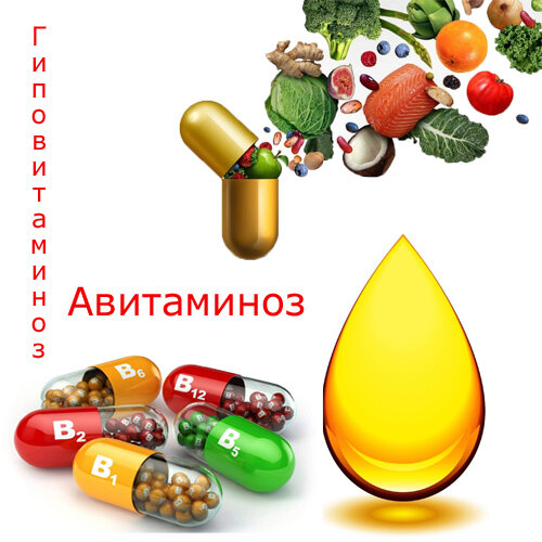 Авитаминоз и гиповитаминоз