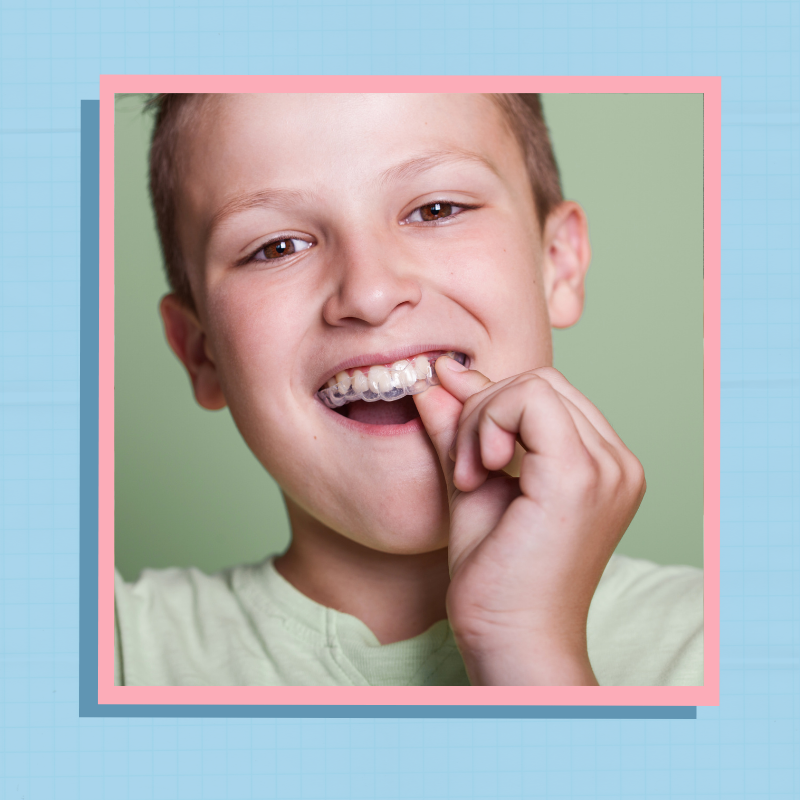 Прозрачные капы для зубов