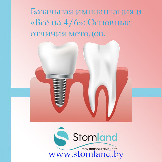 https://www.instagram.com/clinic_stomland_minsk/