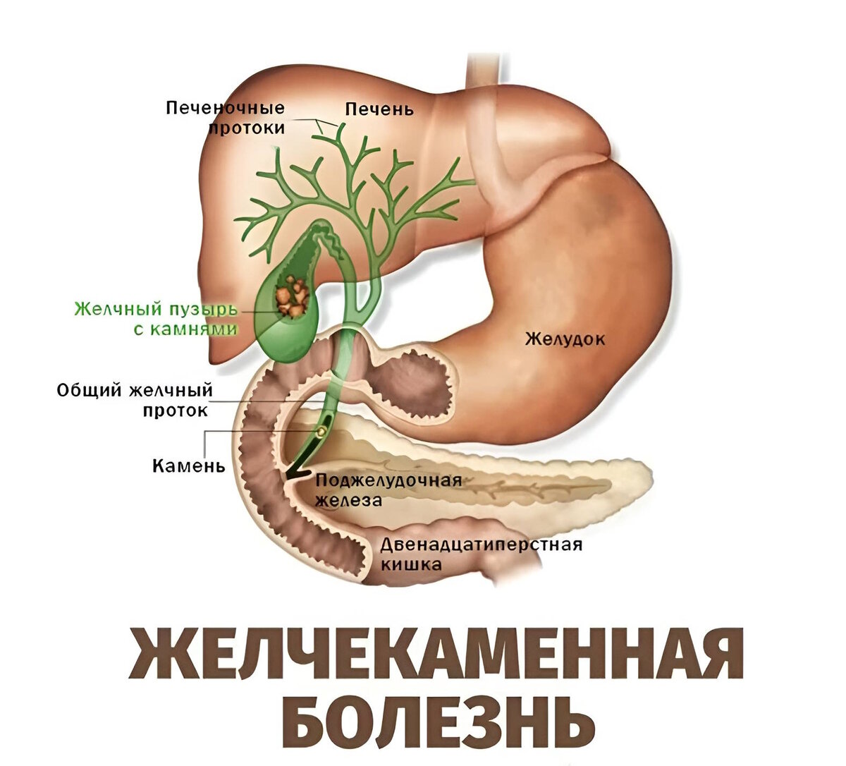 Желчекаменная болезнь анатомия