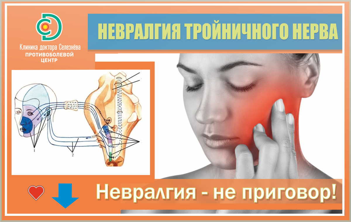 Невралгия лечение. Невралгия тройничного нерва. Невралгия тройничного нерва клиника. Уколы для невралгии тройничного нерва. Уколы от неврит тройничного нерва.