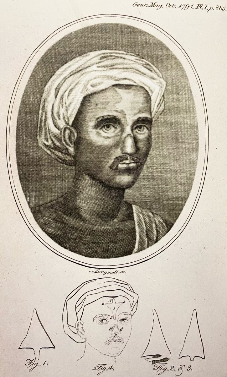 В октябре 1794 г. в лондонском журнале "The Gentlemen's Magazine" впервые в Европе была опубликована статья о реконструкции носа по индийскому методу. В ней описывалось, как пациенту по имени Коуэджи пересадили кожу со лба, чтобы сформировать новый нос.