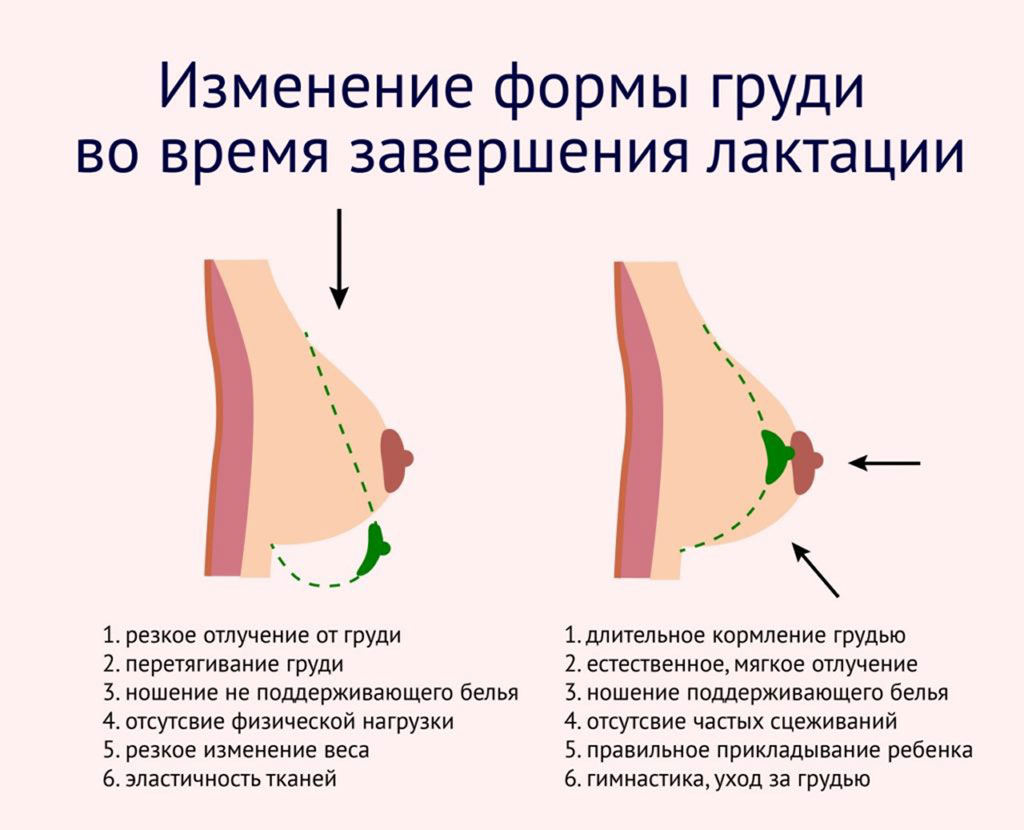 Как сохранить форму груди после родов | Буду лучшей мамой с ФЭСТ | Дзен