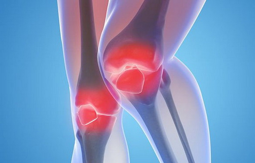 Причины развития артроза коленного сустава