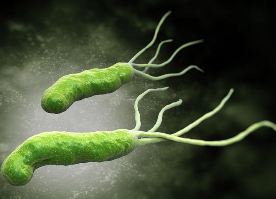 Хеликобактерная инфекция (Helicobacter pylori)