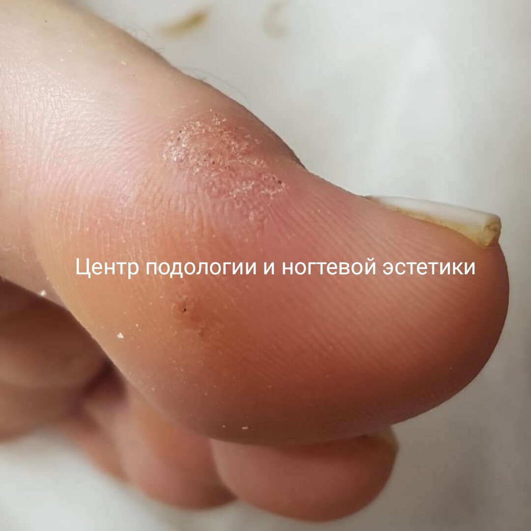 Третий приём