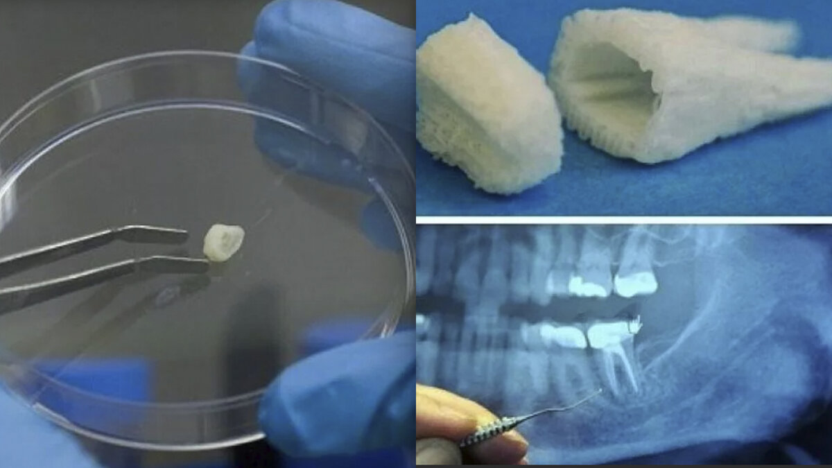 Выращивание зубов