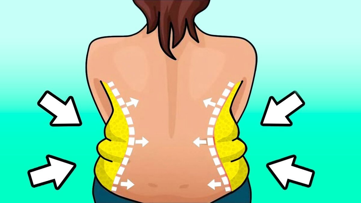 Жировые складки