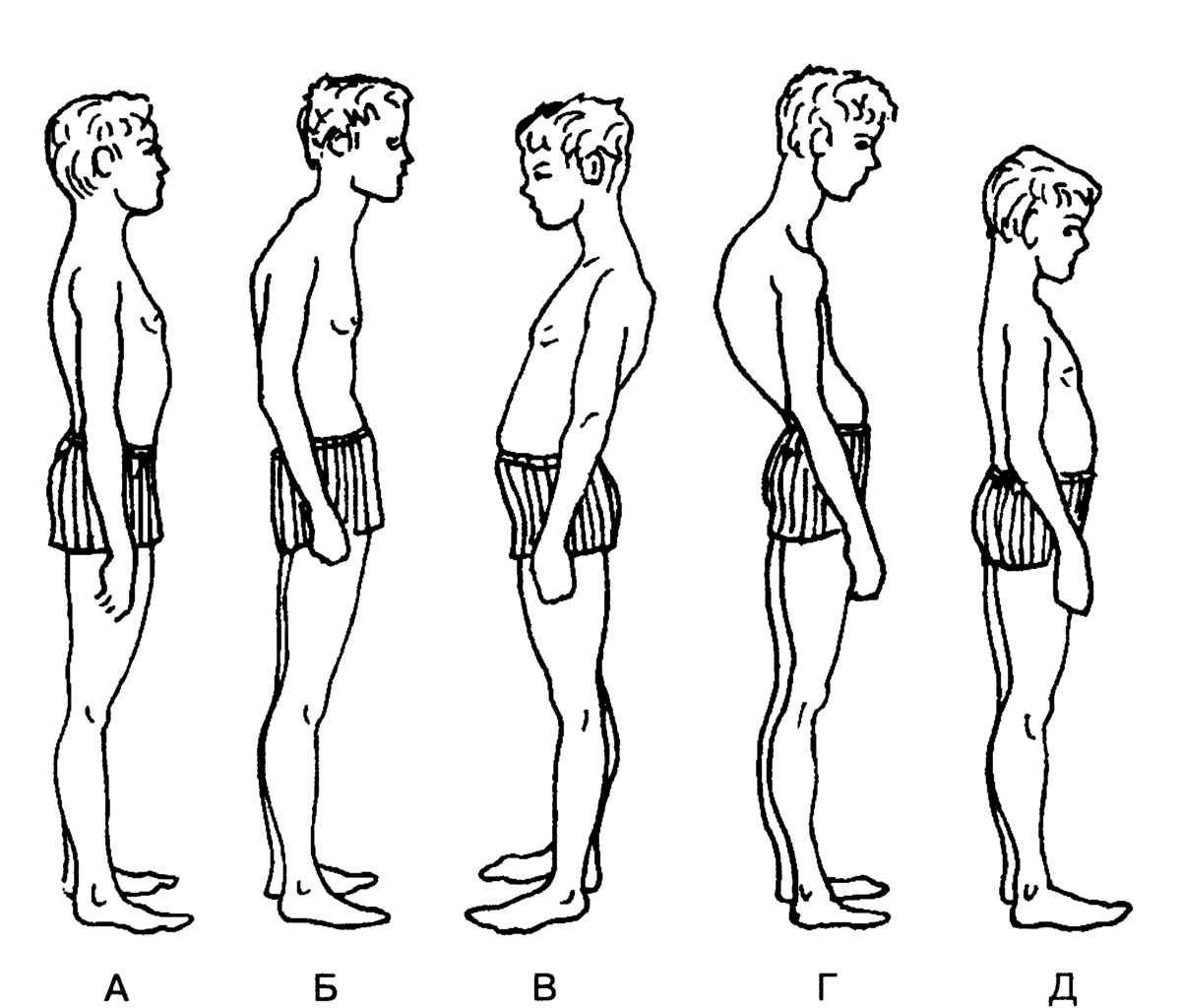 Как исправить осанку - домашние упражнения для прямой спины Bad posture, Improve