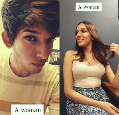 До и после операции