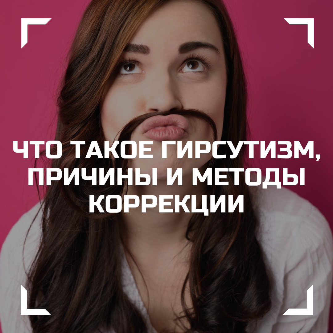 Что такое гирсутизм, причины и методы коррекции | Клиника CosmetoMed | Дзен