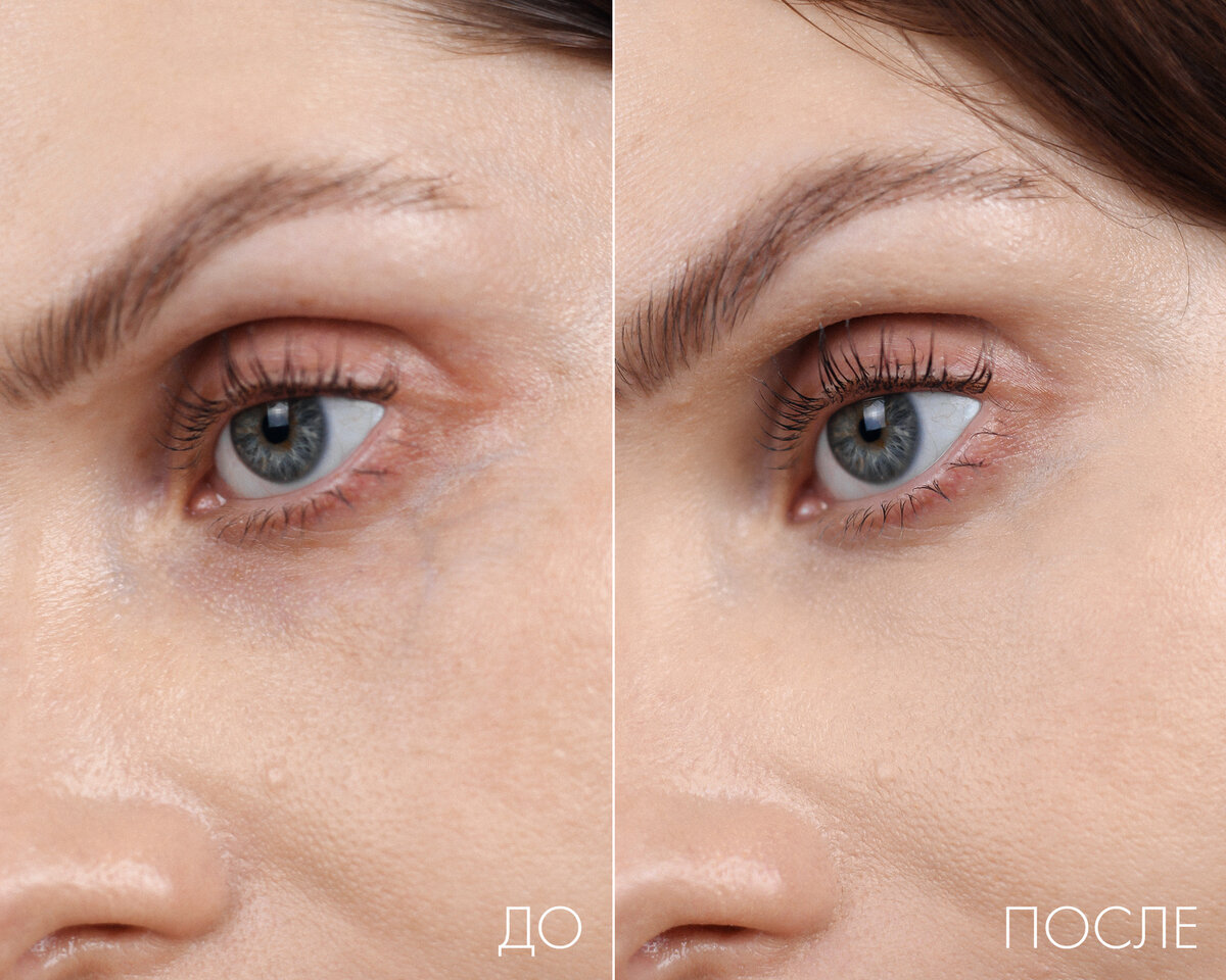 Оттенок 002 Rose Beige с приятным персиково-розовым подтоном отлично подходит для маскировки синевы под глазами.