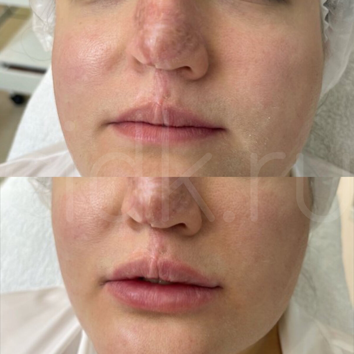 ПЕРЕЗАГРУЗКА ОЛЕСИ