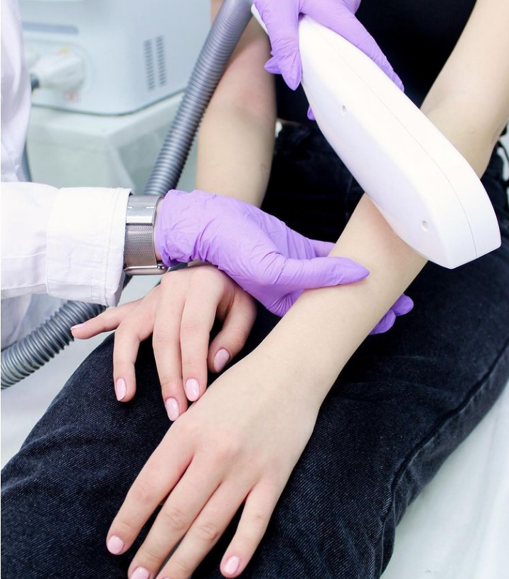 Лазерная эпиляция рук