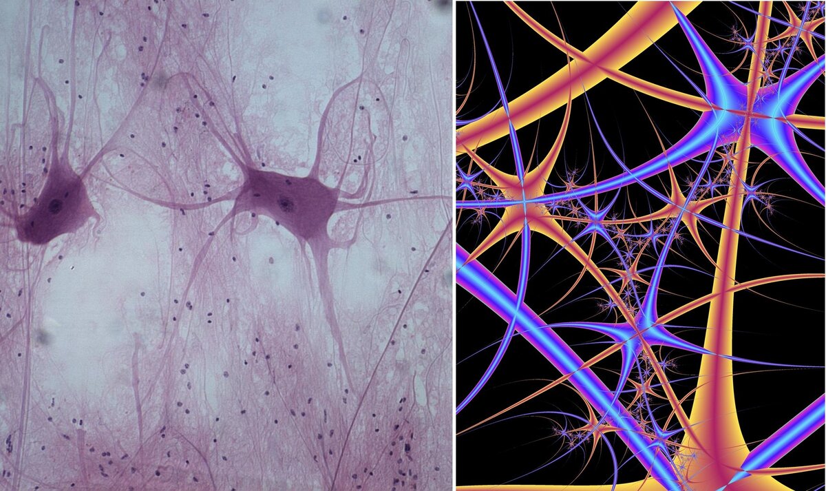 Ад клетке. Нейрон Пуанкаре микрофотография. Фрактал клетки. Нервные клетки Фракталы. Нейроны головного мозга под микроскопом.