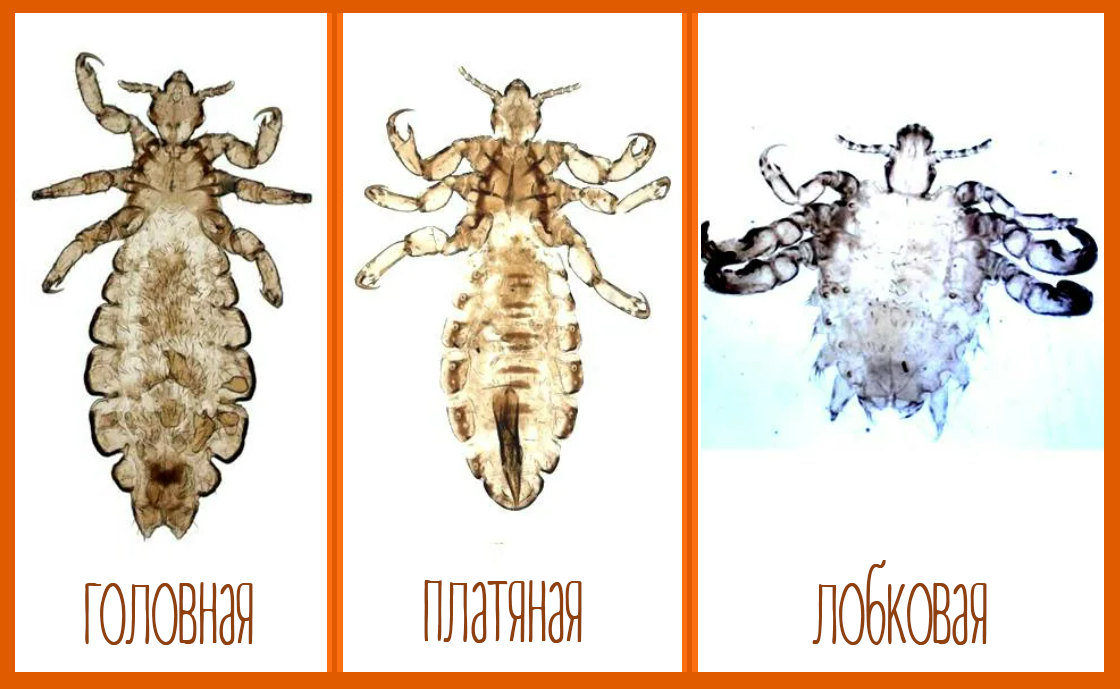 Виды вшей