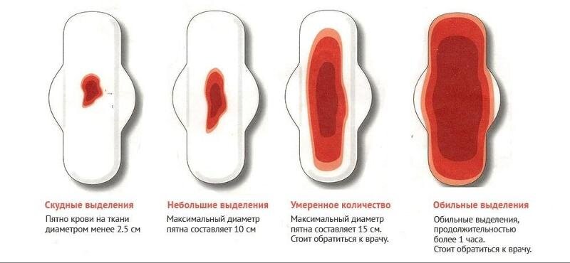 Гипоменорея или скудные месячные – лечение в Киеве - центр «Меддиагностика»