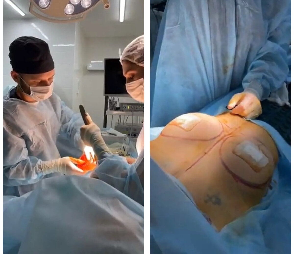 Девушка показала весь процесс в прямом эфире