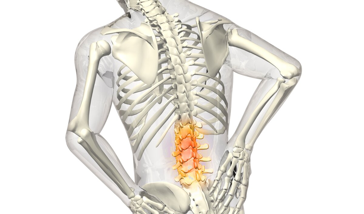 Могут ли грыжи позвоночника