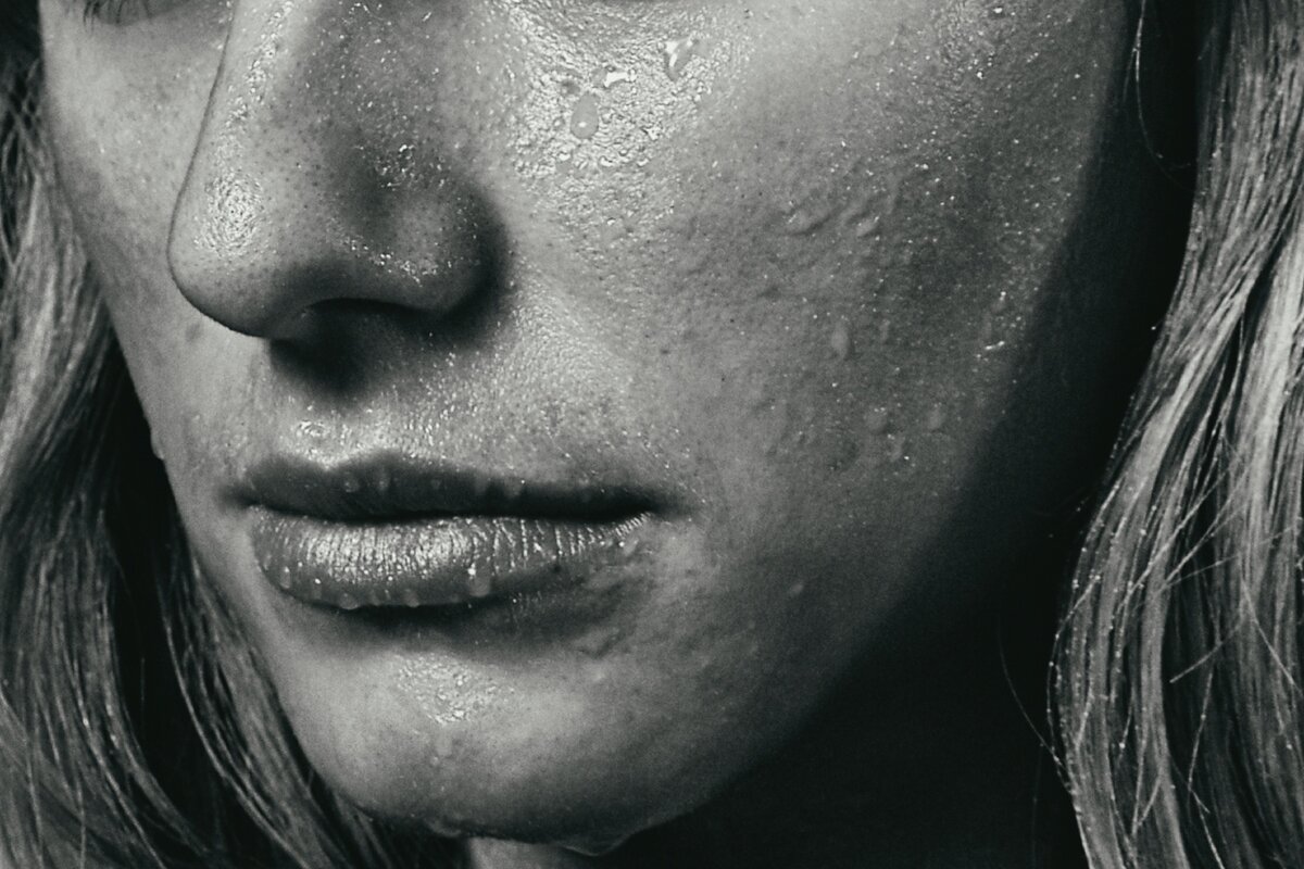 Высокое потоливость в номальных условиях указывает на дисбаланс