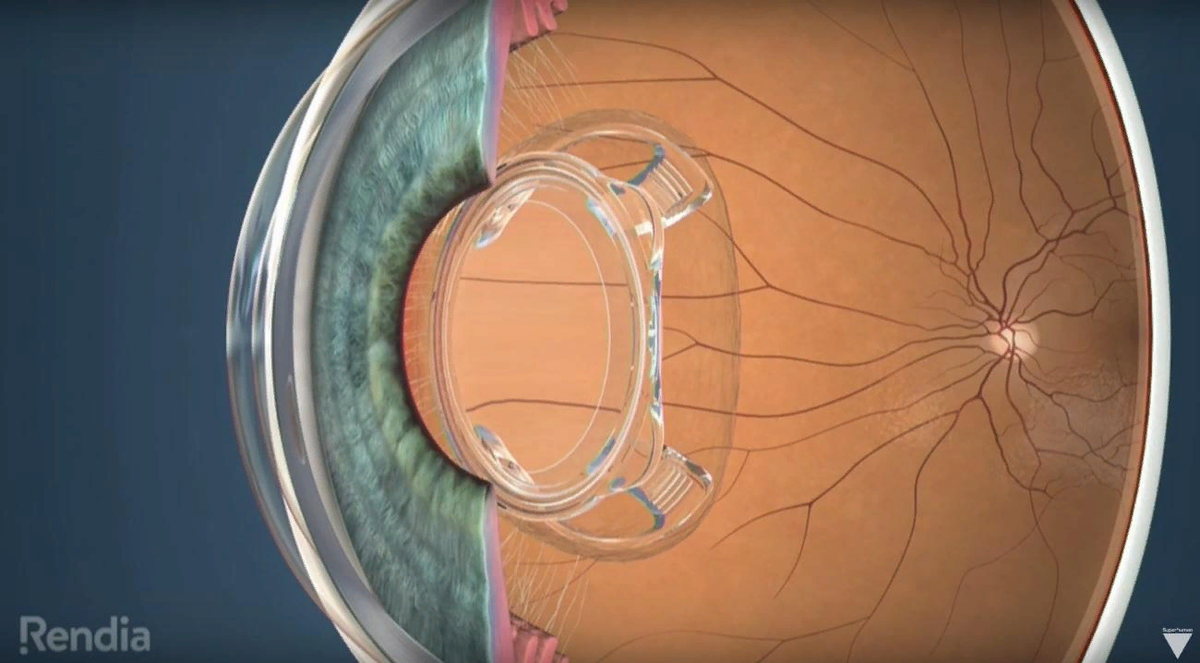 Источник: Яндекс Картинки