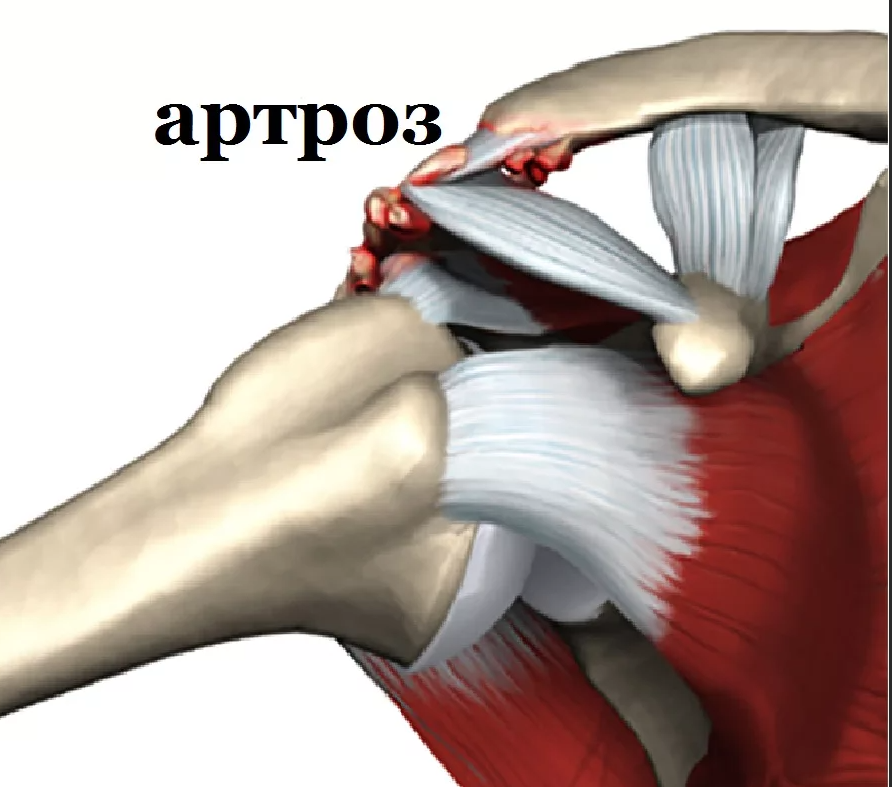 что может произойти