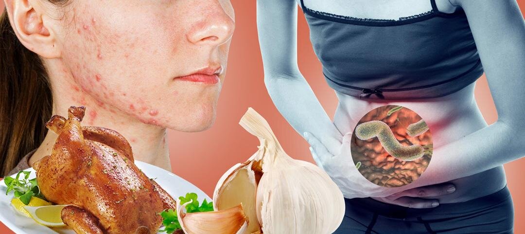 Заражение паразитами человеческого организмы - бич современного мира