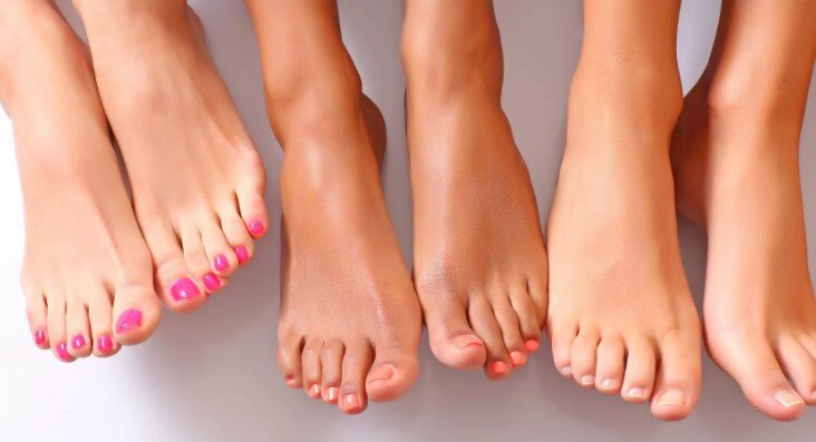 Каковы причины появлениях сросшихся пальцев на ногах?