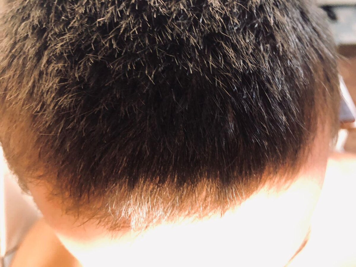 Голова без перхоти!