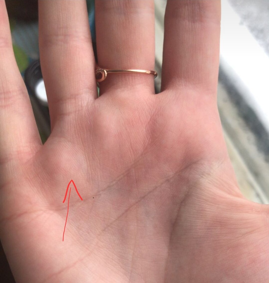 Хорошо развитый холм Аполлона.