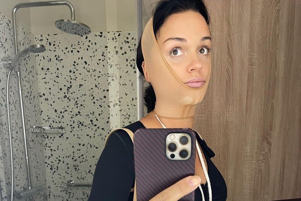     Певица Слава сделала несколько пластических операций. Фото: соцсети.