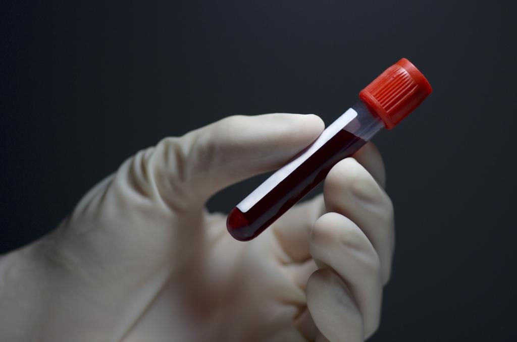 Образец SCP - 008.