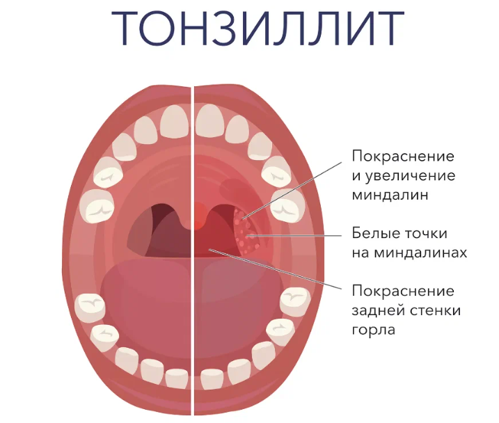 В чем разница