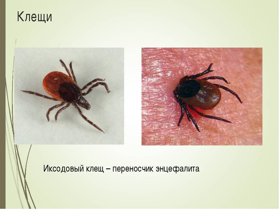 Клещевой энцефалит картинки