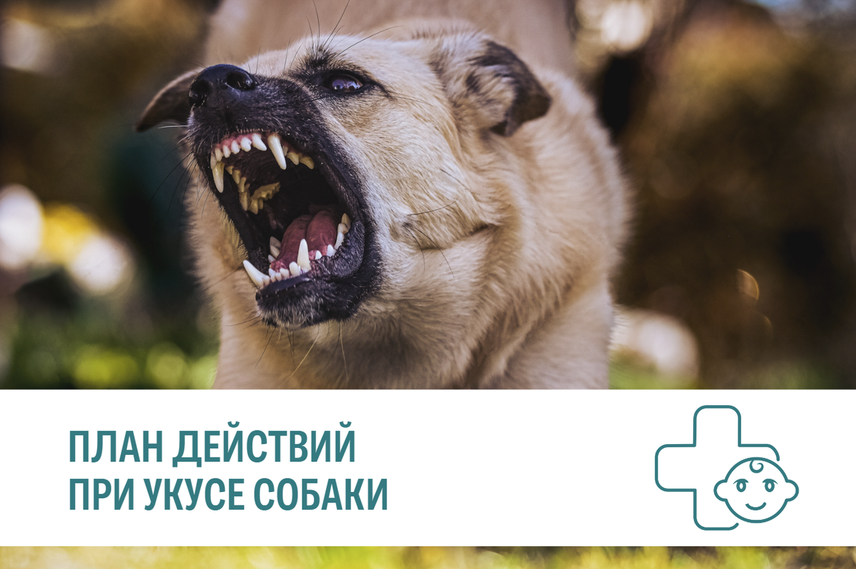 Моральный вред за укус собаки. Моральный вред за укус собаки. Моральный вред за укус собаки. Компенсация морального вреда за укус собаки. Исковое заявление на хозяина собаки укусившей ребенка.
