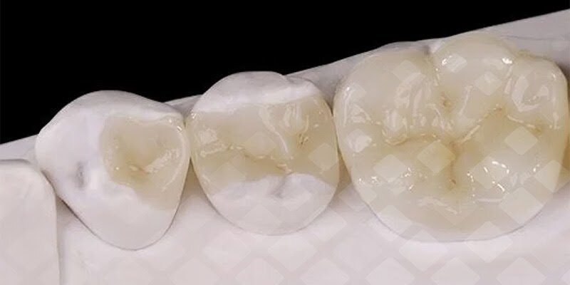 Векторное изображение зуба. Зуб 4 буквы. Премоляры зубы анатомия. Второй моляр нижней челюсти анатомия. Премоляр верхней челюсти анатомия.