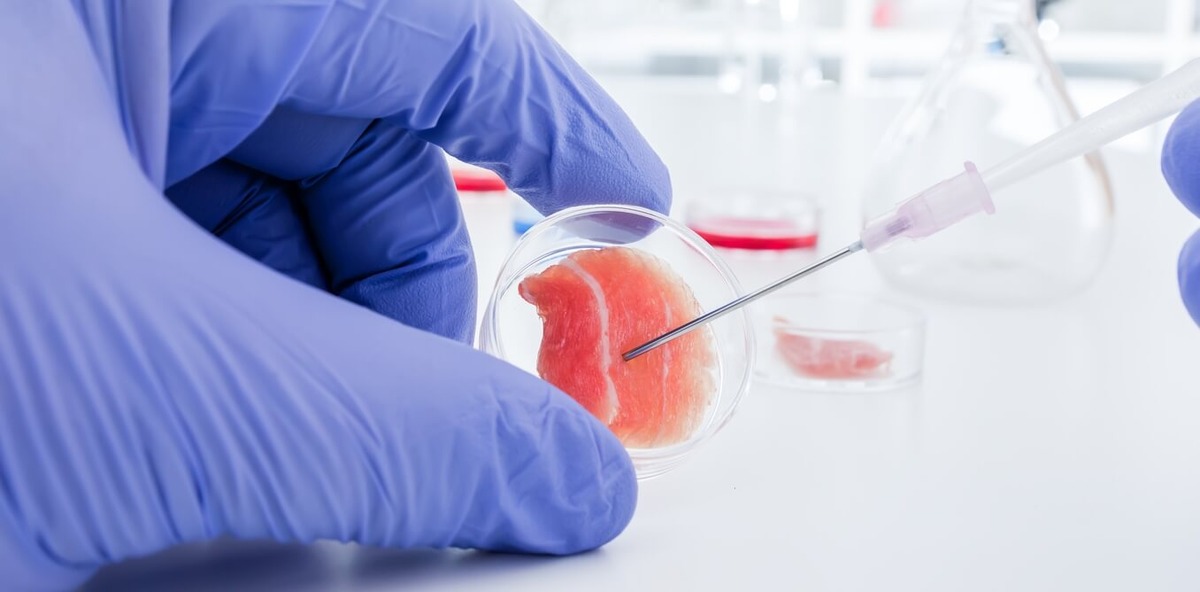 Терапия стволовыми клетками в ортопедии