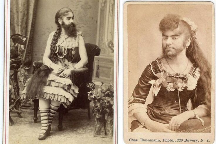 История людей уродов фото