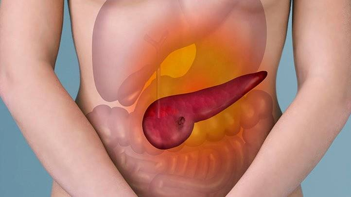 Medicul a spus cum doare pancreasul: 9 semne de pancreatită acută și cronică