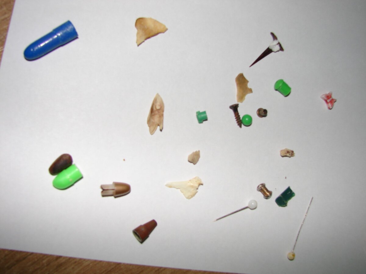 Вот такое доставала у детей  опытный  врач-эндоскопист