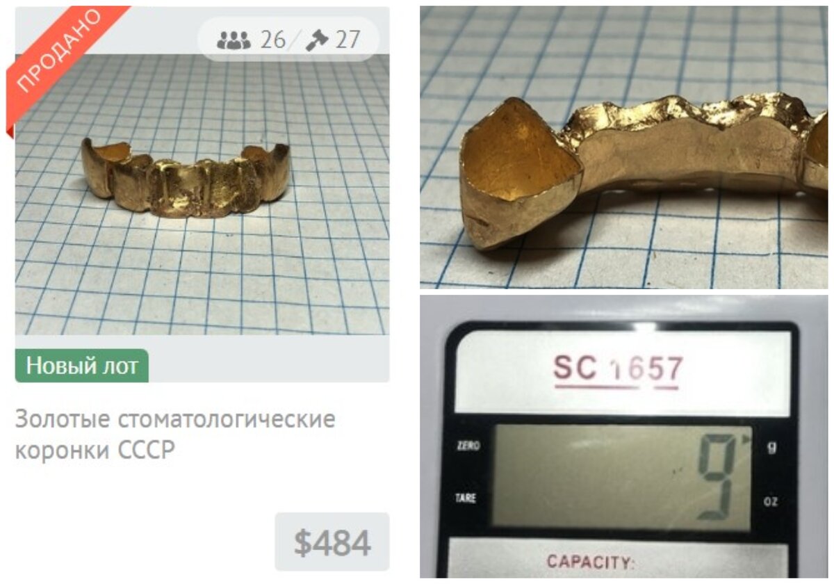 Золотые коронки. СССР коронки. Проба золота для зубных коронок. Проба золота на зубные коронки в СССР.