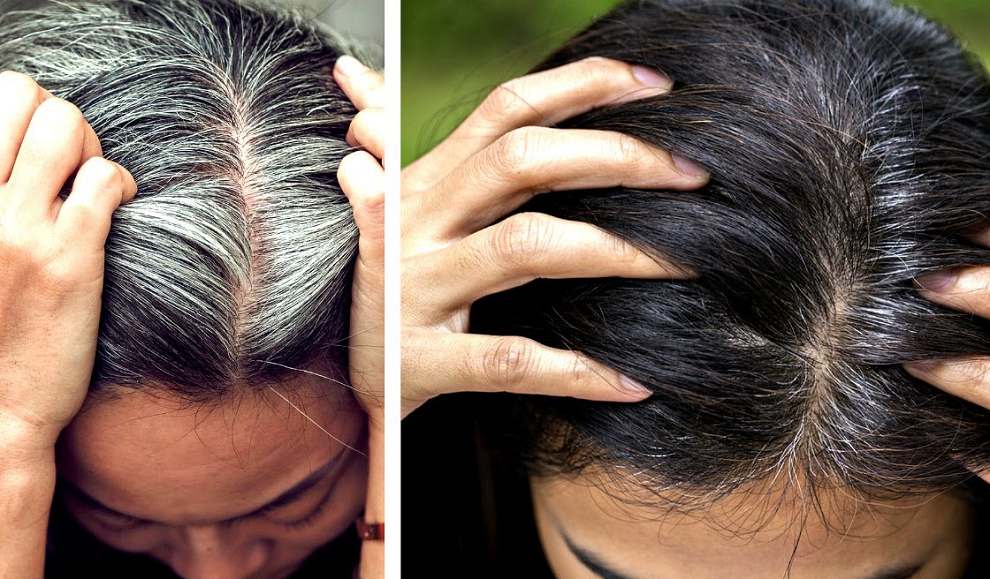 рву на себе волосы. возможно ли поседеть. возможно ли поседеть. седина волос от страха. колорирование седых волос.