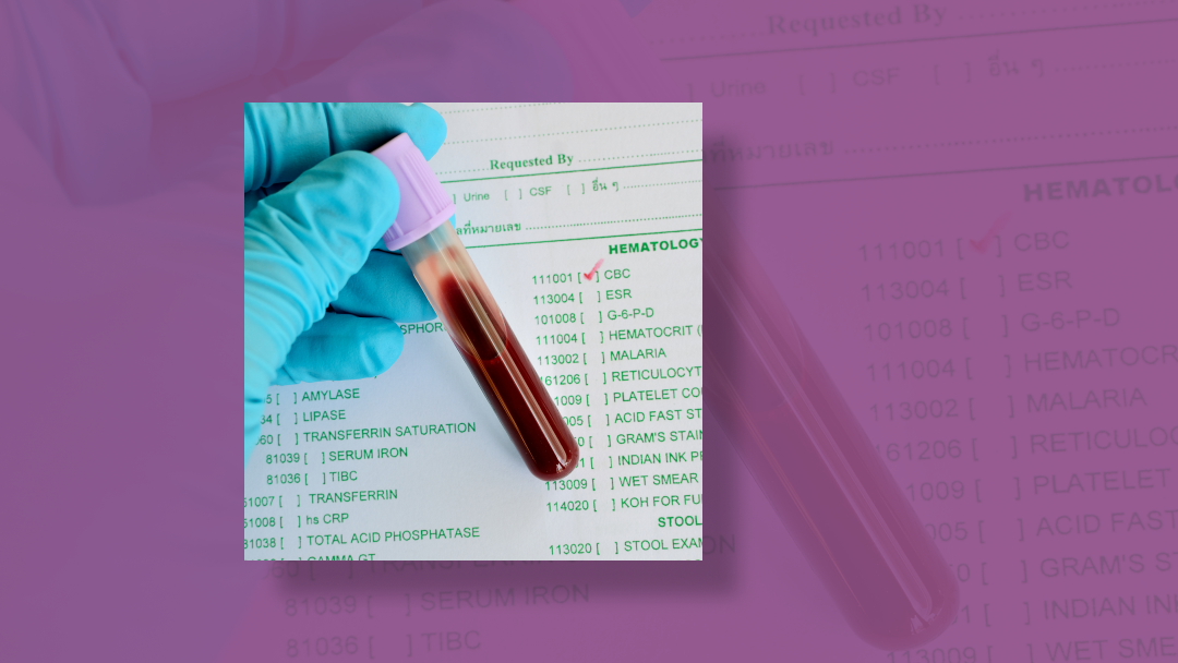 Анализ крови из пальца можно есть. ВК анализ крови. Анализ крови инструмент. Кровь анализ крови. Специалист по анализу крови.