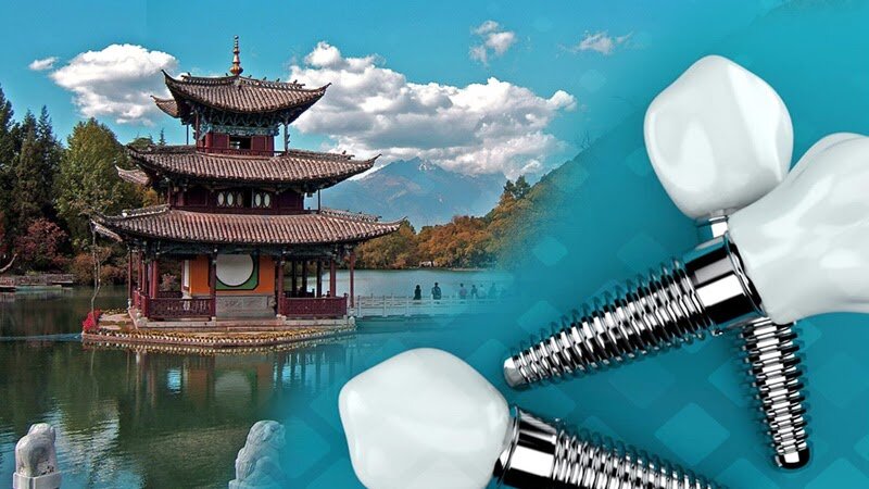 Но правда ли это так выгодно? Разбираем положительные и отрицательные стороны установки имплантов в Китае. Фото: Яндекс.Картинки.