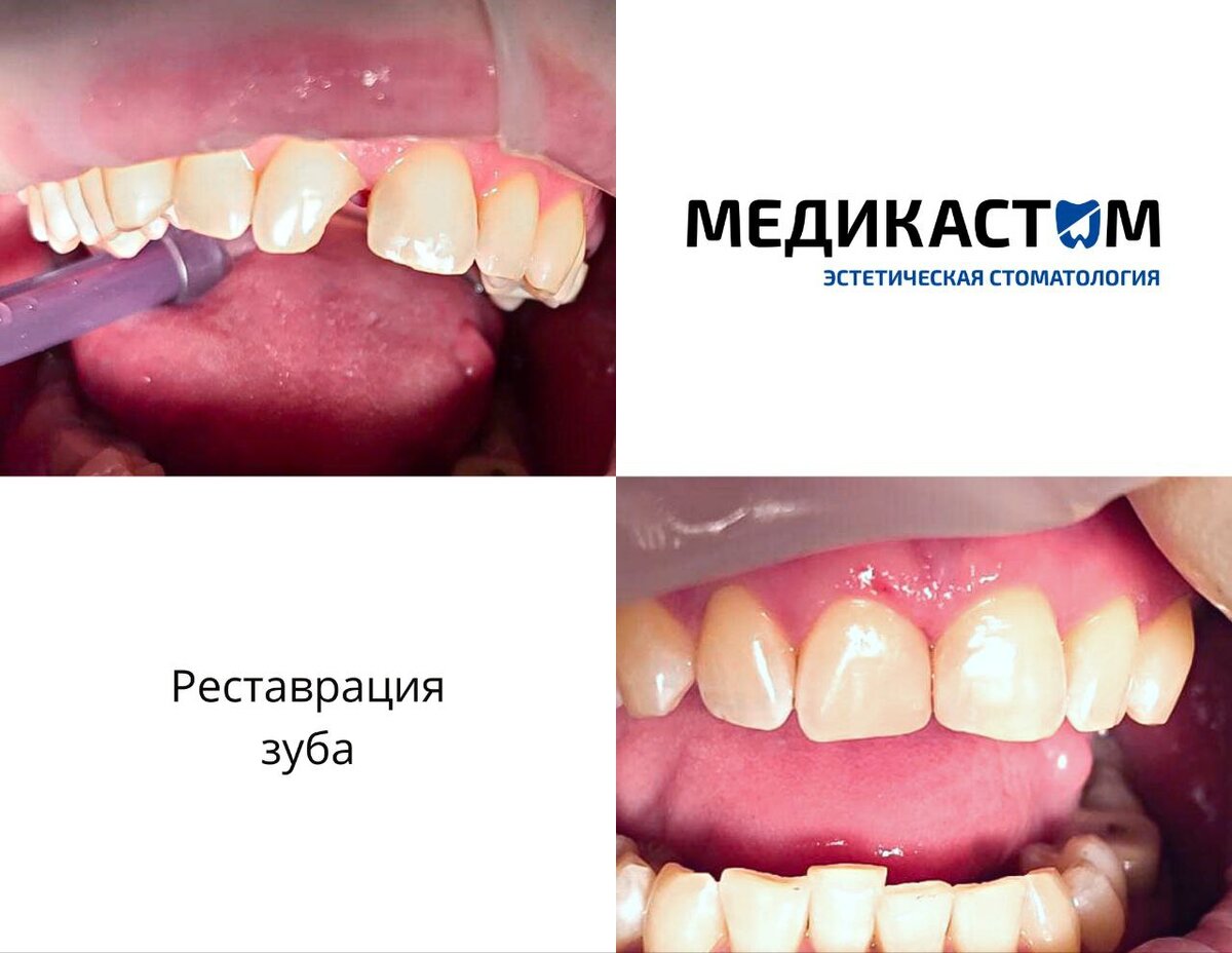 В наших клиниках «Медикастом» перед любыми эстетическими процедурами обязательно проводится полное обследование. Только после него наши специалисты.