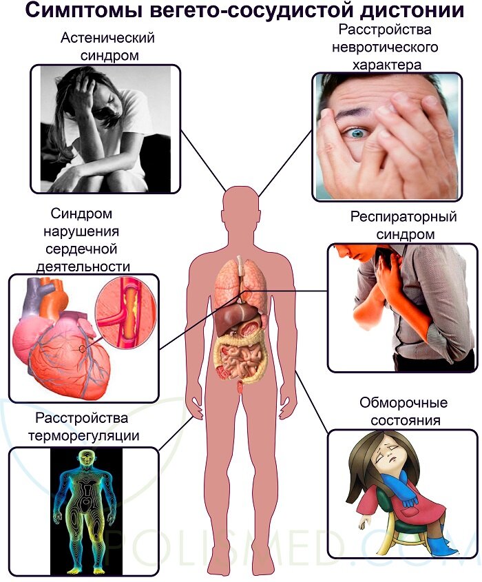 Симптоматика ВСД