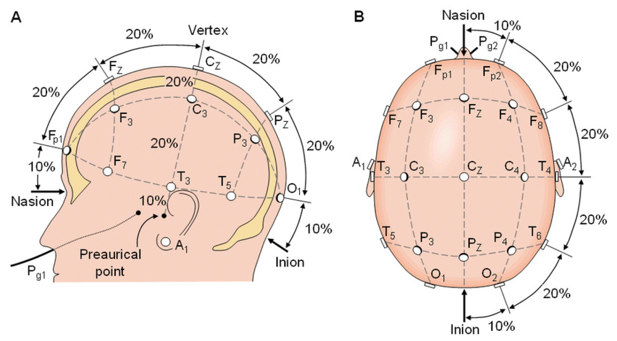 Система ээг. Система 10-20 электродов для ЭЭГ. Схема расположения электродов 10-20 ЭЭГ. Международная схема электродов ЭЭГ 10-20. Схема наложения электродов ЭЭГ.